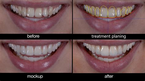 Smile Design Dental Clinic.